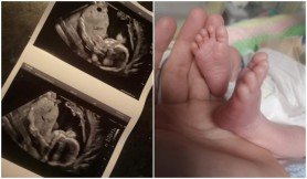 „Miracolul meu de Crăciun". O femeie a devenit mamă deși medicii i-au spus că bebelușul a murit în pântece